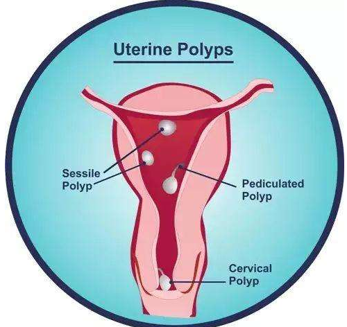 商丘三次试管不成功还需要做吗？试管婴儿做了3次失败还能做吗？